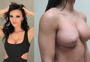 Brittney Atwood Nude Boob Job Fotos Fleated