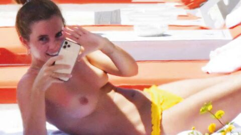 Emma Watson Nudes Topless Leaked Holiday Sun Sun Tits